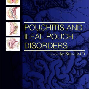 Pouchitis and Ileal Pouch Disorders: A Multidisciplinary Approach for Diagnosis and Management
