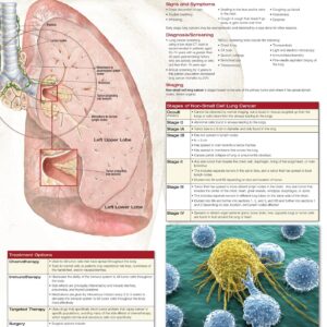 Non-Small Cell Lung Cancer-ISBN: 9781496369529
