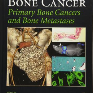 Bone Cancer: Primary Bone Cancers and Bone Metastases