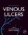 Venous Ulcers