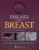 Diseases of the Breast 5e
