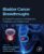 Bladder Cancer Breakthroughs: A Global Perspective on Diagnosis, Treatment, and Patient Care