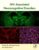 HIV-Associated Neurocognitive Disorders