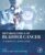 Metabolomics of Bladder Cancer: An Emerging Application