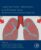 Targeting Chronic Inflammatory Lung Diseases Using Advanced Drug Delivery Systems