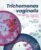 Trichomonas vaginalis: Pathogenesis, Diagnosis, and Treatment