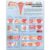 Common Gynecological Disorders Anatomical Chart